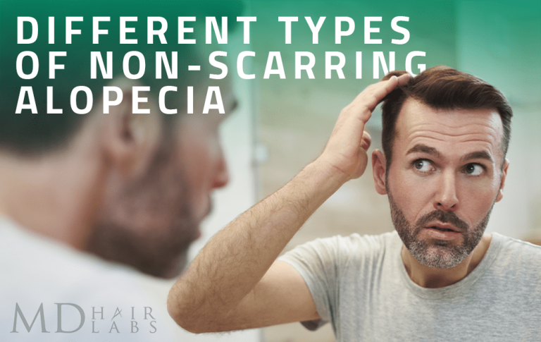 Different Types of Non-Scarring Alopecia
