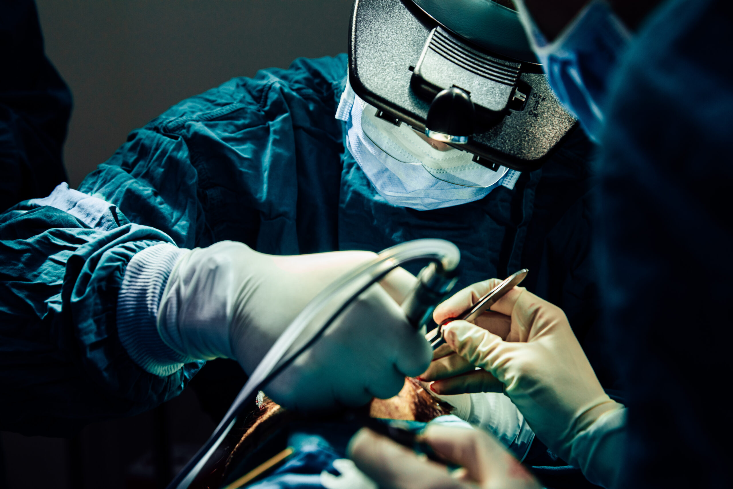 MD Hair Labs surgeon performing a hair transplant procedure
